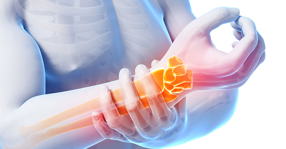 Hernando, Horn Lake & Olive Branch natural carpal tunnel treatment